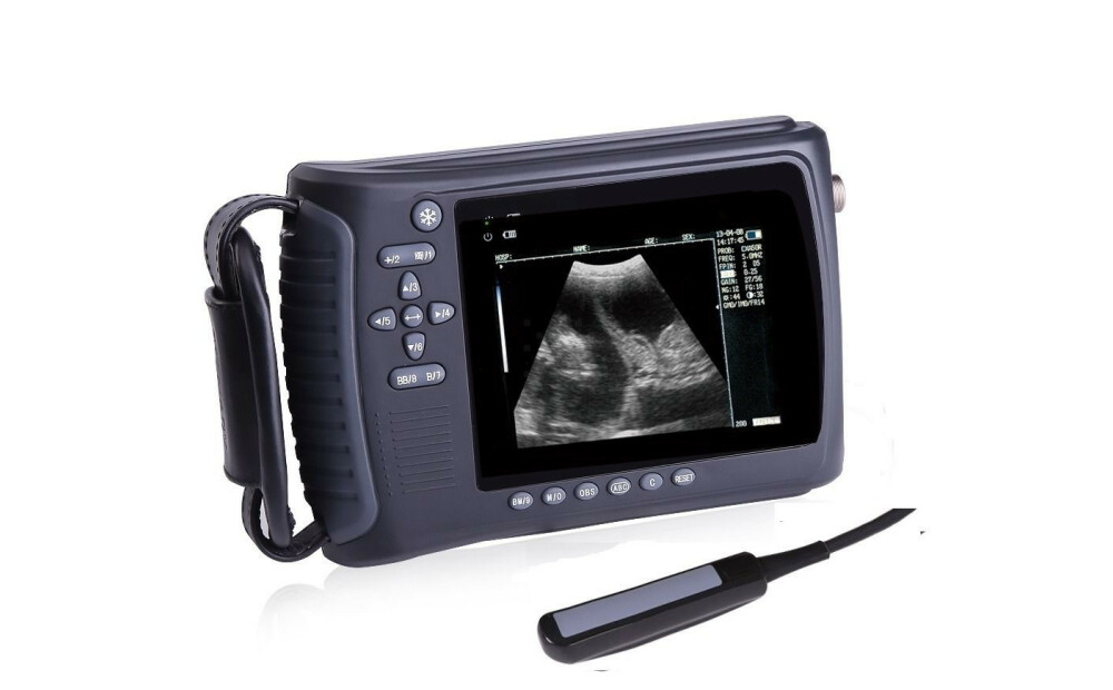 New Ultrasound Scanner - 6